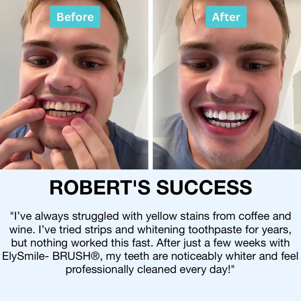 Elysmile-Brush ™